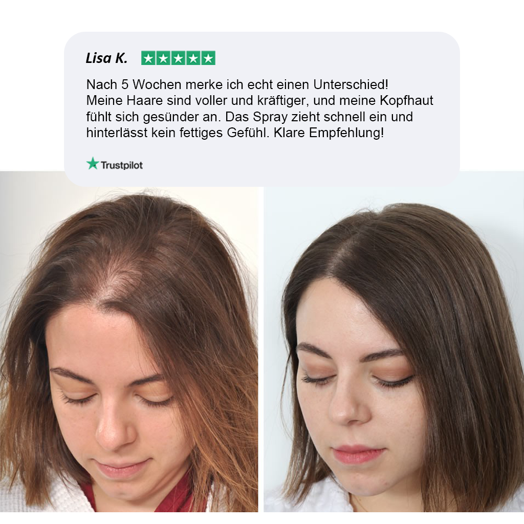 Veloris - Das ultimative Haarwuchs Spray