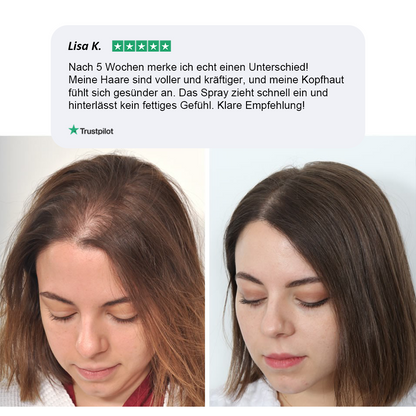 Veloris - Das ultimative Haarwuchs Spray